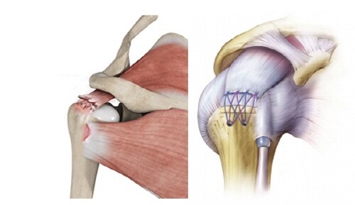 16430875141643087514436_1643087514.jpg